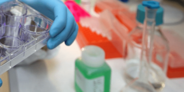Tumori, al via studio per ridurre rischio recidive da cancro al seno