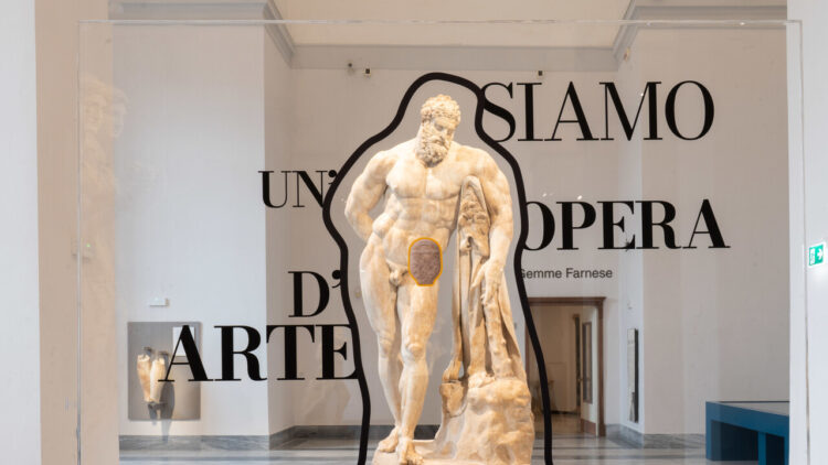 ‘Oltre il punto di vista’, capolavori collezione Farnese indossano presidi per stomia